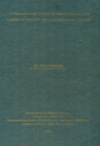Image of A Comparative Study Between Porcelain Laminate Veneer And Conventional Crown