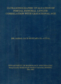 Image of Ultrasonographic Evaluation Of Foetal Femoral Length : Correlation With Gestational Age