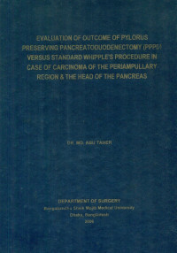 Image of Evaluation Of Outcome Of Pylorus Preserving Pancreatoduodenectomy (PPPD) Versus Standard Whipple's Procedure In Case Of Carcinoma Of Periampullary Region & The Head Of The Pancreas