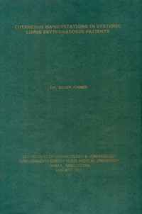 Image of Cutaneous Manifestations In Systemic Lupus Erythematosus Patients