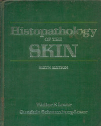 Image of Histopathology OF THE SKIN