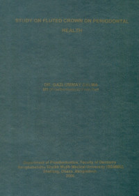 Image of Study On Fluted Crown On Periodontal Health