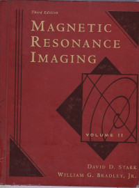 Image of Magnetic resonance imaging