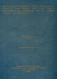 Image of Morphometric Measurements of the Posterior Cranial Fossa in Adult Patients with Chiari Type I Malformation and Comparison with the Patients without Chiari I Malformation