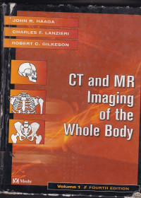 Image of CT and MR imaging of the whole body