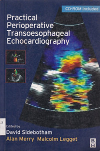 Image of Practical Perioperative Transoesophageal Echocardiography