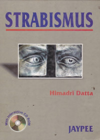Image of Strabismus