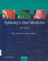 Image of Tyldesley's Oral Medicine