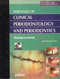 Image of Essentials os Clinical Periodontology and Periodontics