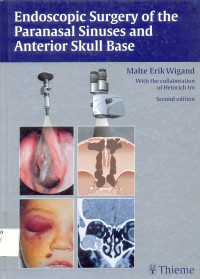 Image of Endoscopic Surgery of the Paranasal Sinuses and Anterior Skull Base