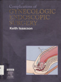 Image of Complications of gynecologic endoscopic surgery
