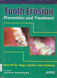 Image of Tooth Erosion Prevention and Treatment