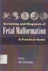 Image of Screening and Diagnosis of Fetal Malformation.;A Practieal Guide.