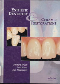 Image of Esthetic dentistry and ceramic restorations