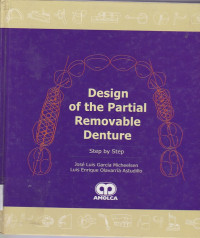 Image of Design of the Partial Removable Denture