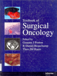 Image of Textbook of Surgical Oncology