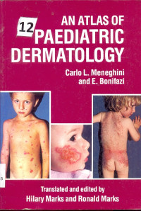 Image of AN ATLAS OF PAEDIATRIC DERMATOLOGY