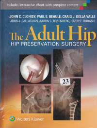 Image of The Adult Hip Hip Preeservation Surgery