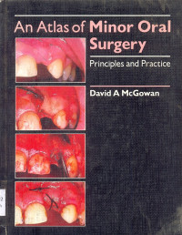 Image of An Atlas of Minor Oral Surgery