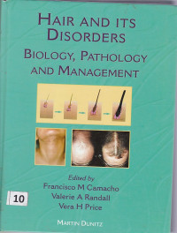Image of Hair and Its Disorders Biology, Pathology and Management