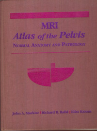 Image of Mri Alas of the Pelvis Normal Anatomy and Pathology.