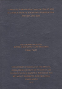 Image of Computed  Tomographic  Evaluation  of  non  Alcoholic  Hepatic  Steatosis-  Correlation  With  Splenic  Size