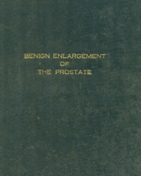 Image of Benign enlargement of the prostate