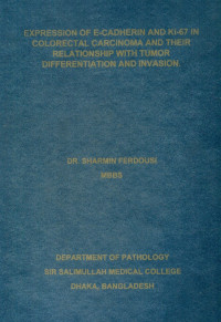 Image of Expression of E-Cadherin and Ki-67 in Colorectal Carcinoma and their Relationship with Tumor Differentiation and Invasion