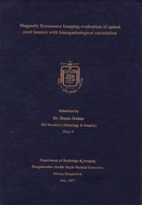 Image of Magnetic Resonance Imaging Evaluation of Spinal Cord Tumors with Histopathological Correlation