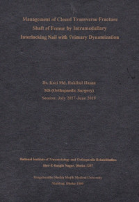 Image of Management of Closed Transverse Fracture Shaft of Femur by Intramedullary  Interlocking Nail with Primary Dynamization
