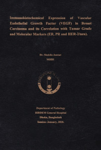 Image of Immunohistochemical Expression of Vascular Endothelial Growth Factor (VEGF) in Breast Carcinoma and its Correlation with Tumor Grade and Molecular Markers (ER,PR and HER-/neu)