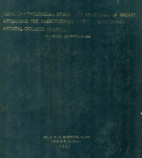 Image of Clinicopathological Study Of Carcinoma Of Breast Attending The Radiotherapy Department, Dhaka Medical College Hospital - A Study Of Fifty Cases